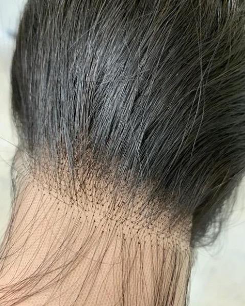 5x5 HD CLOSURES